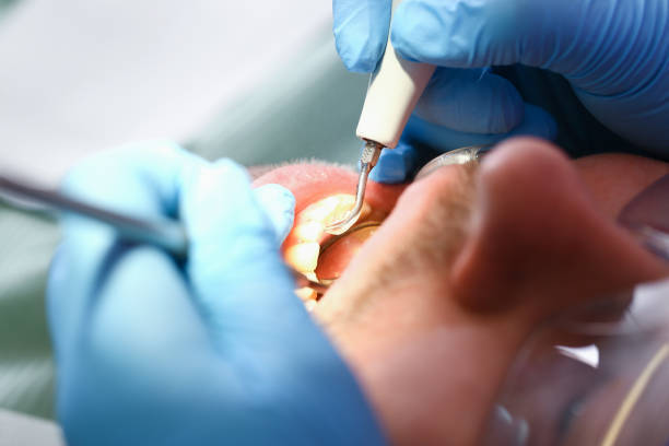 Emergency Gum Pain Relief in NE